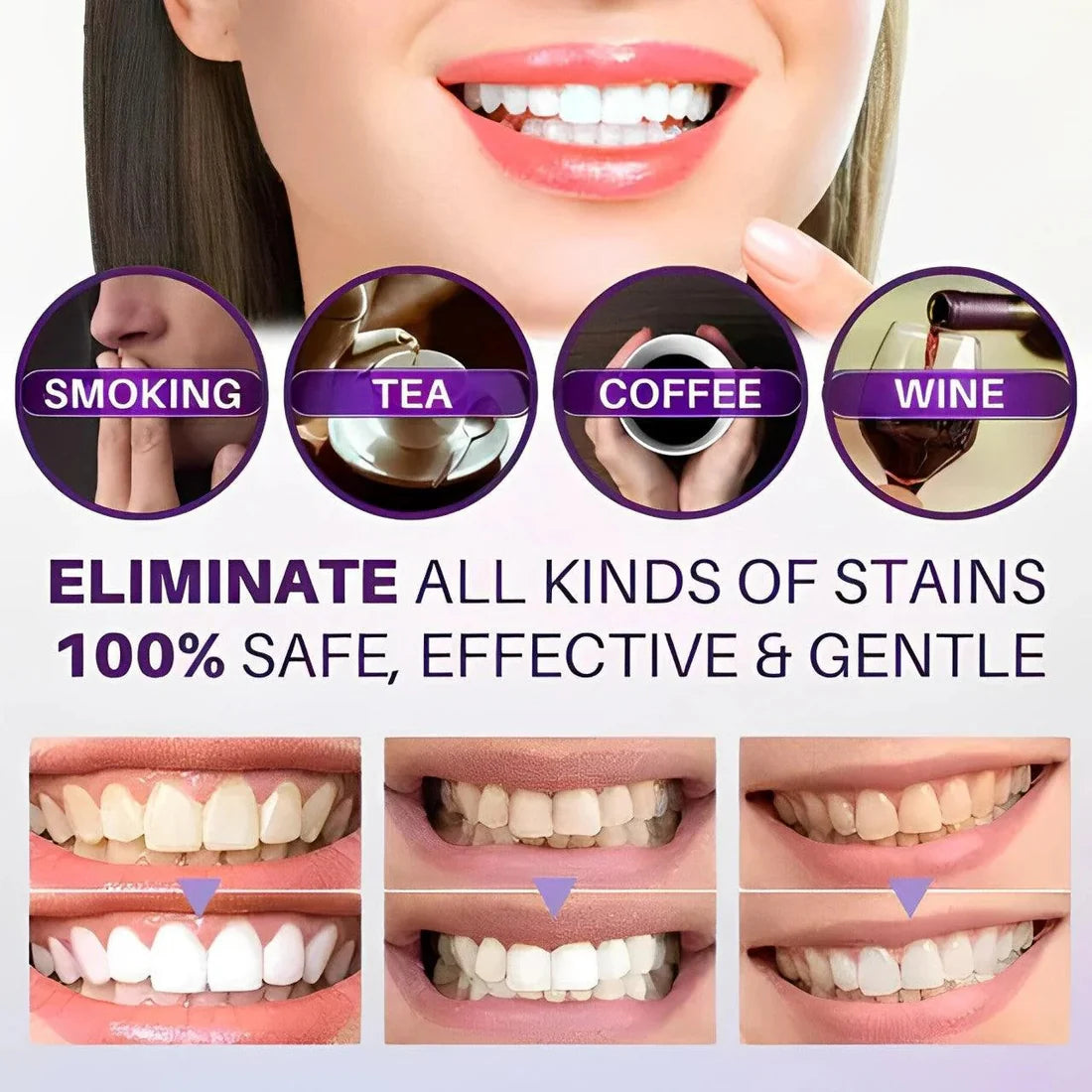 HiSmile V34 Teeth Brightening Serum